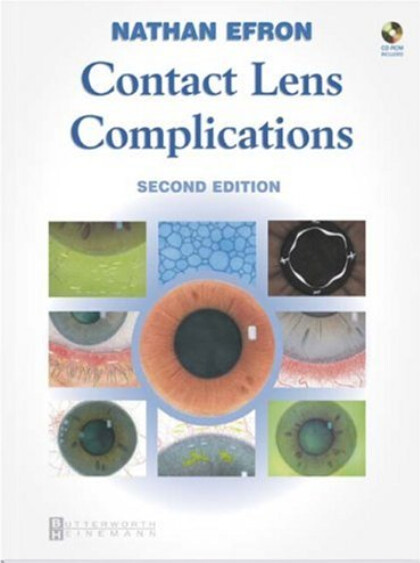 Contact lens complications