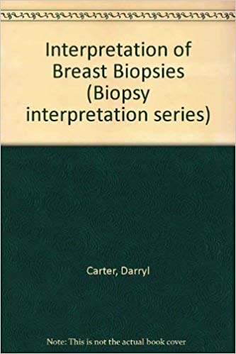 Interpretation of breast biopsies