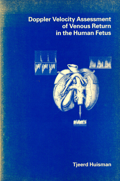Doppler velocity assessment of venous return in the human fetus