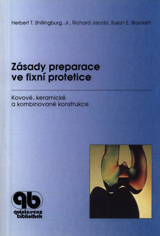 Zásady preparace ve fixní protetice : kovové, keramické a kombinované konstrukce