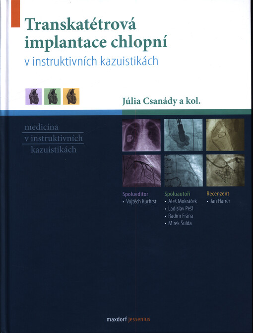 Transkatétrová implantace chlopní v instruktivních kazuistikách