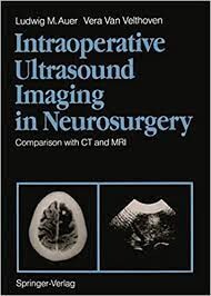 Intraoperative ultrasound imaging in neurosurgery : comparison with CT and MRI