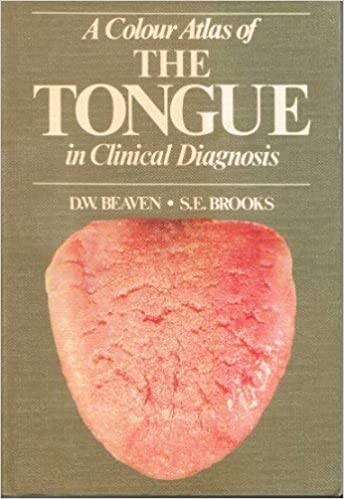 A Colour Atlas of the Tongue in Clinical Diagnosis