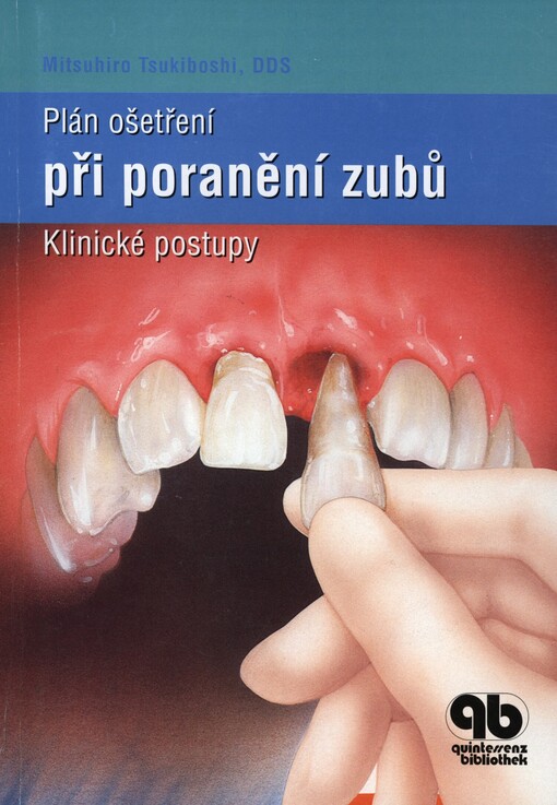 Plán ošetření při poranění zubů :klinické postupy