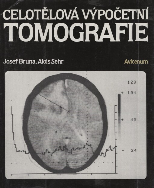 Celotělová výpočetní tomografie
