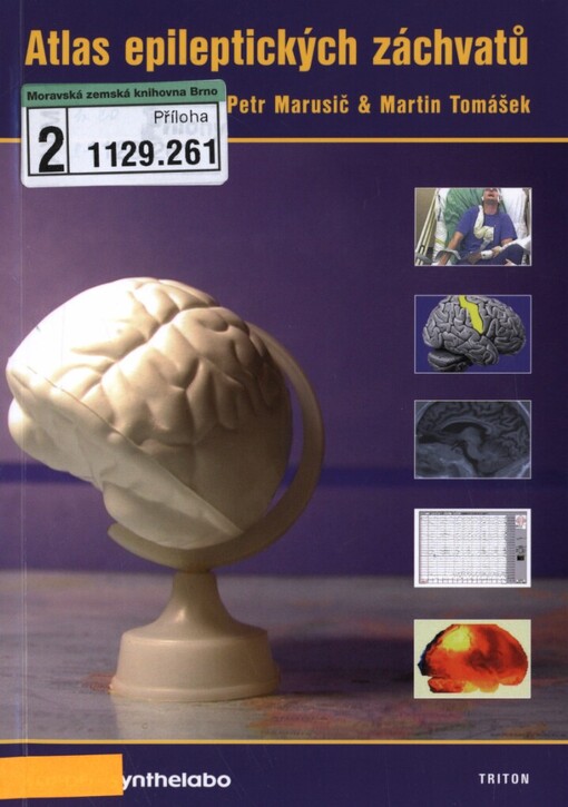Atlas epileptických záchvatů