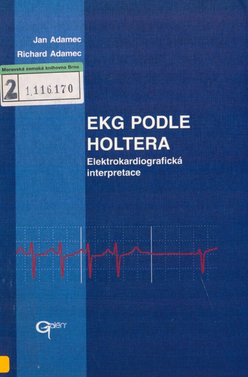 EKG podle Holtera: elektrokardiografická interpretace
