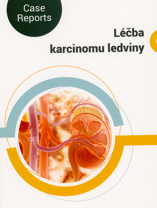 Léčba karcinomu ledviny : case reports