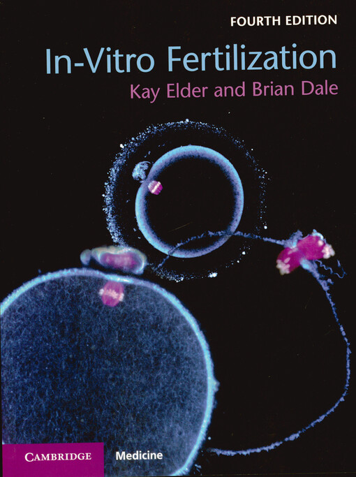 In-vitro fertilization