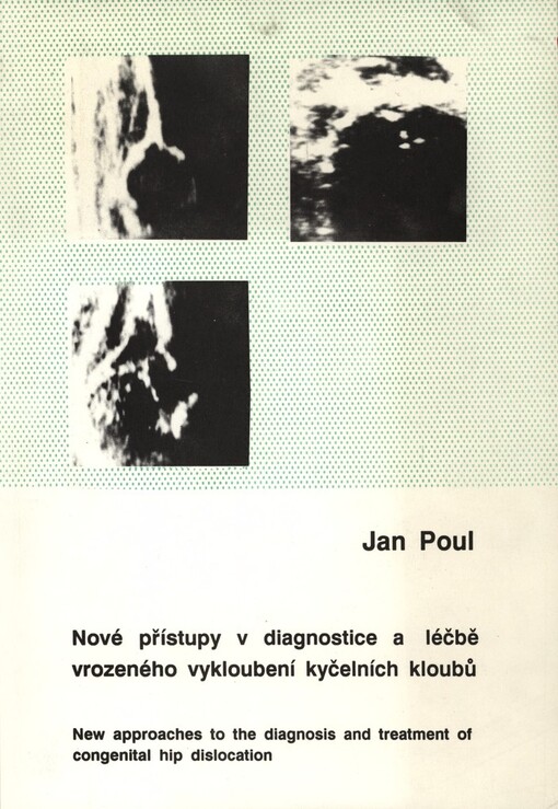 Nové přístupy v diagnostice a léčbě vrozeného vykloubení kyčelních kloubů =: New Approaches to the Diagnosis and Treatment of Congenital Hip Dislocation