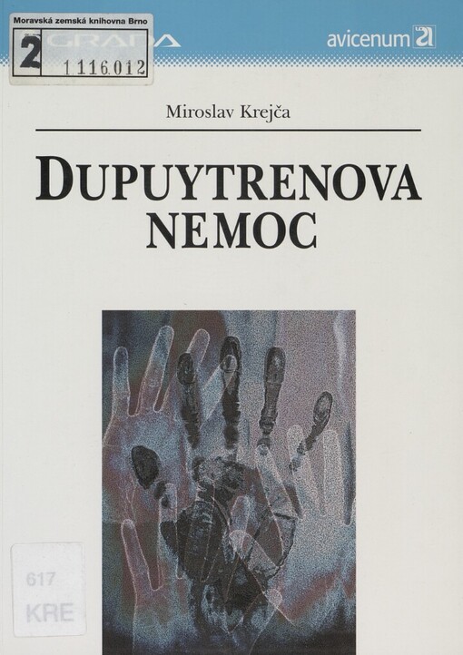 Dupuytrenova nemoc