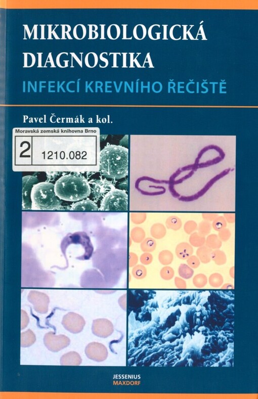 Mikrobiologická diagnostika infekcí krevního řečiště