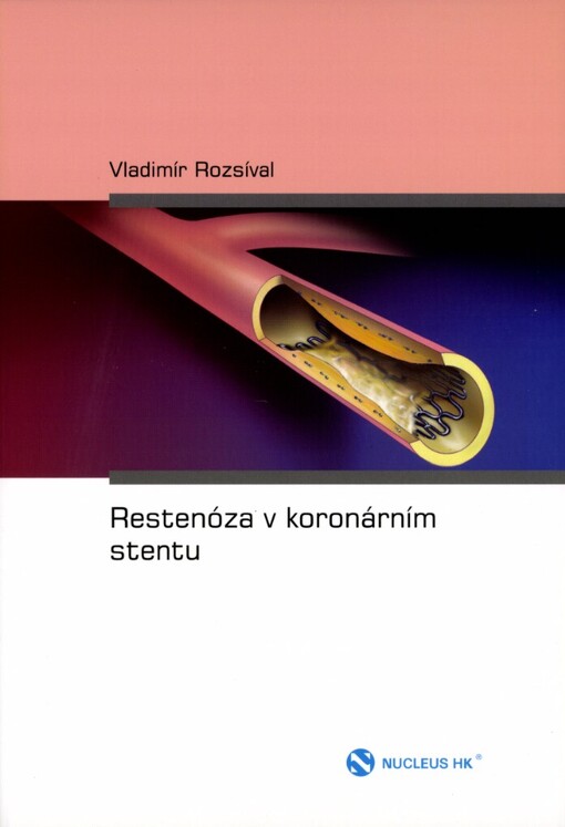 Restenóza v koronárním stentu