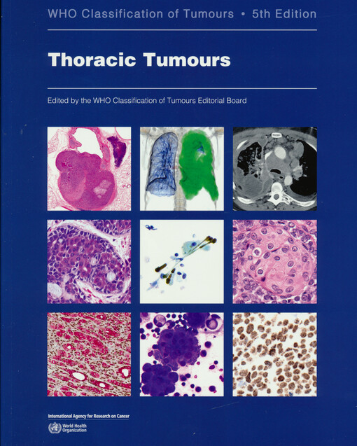 Thoracic tumours