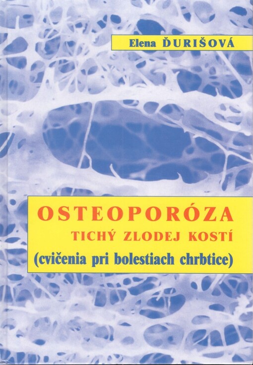 Osteoporóza - tichý zlodej kostí