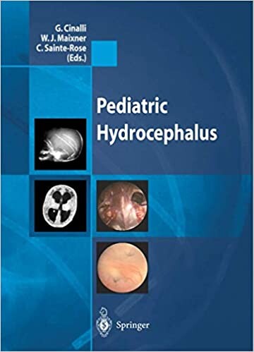 Pediatric Hydrocephalus