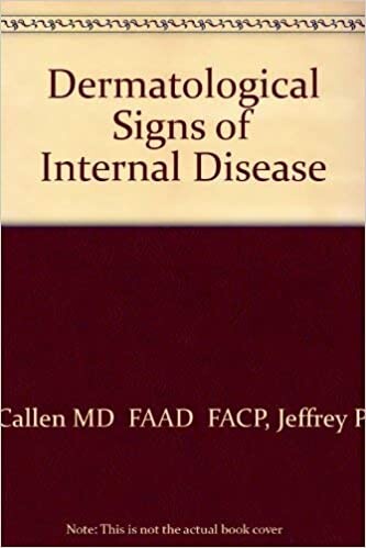 Dermatological Signs of Internal Disease