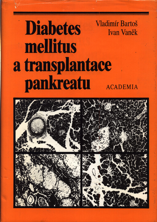 Diabetes mellitus a transplantace pankreatu