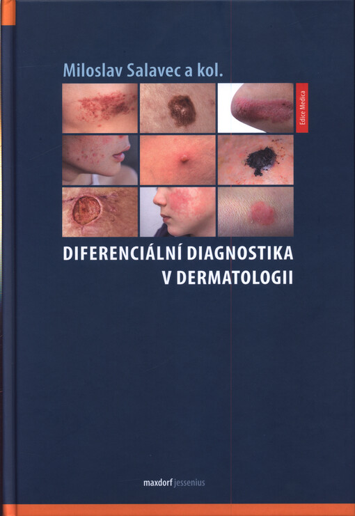 Diferenciální diagnostika v dermatologii