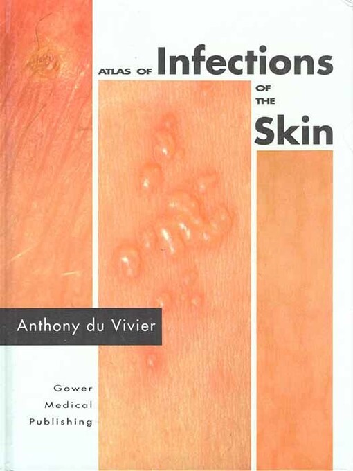 Atlas of infections of the skin