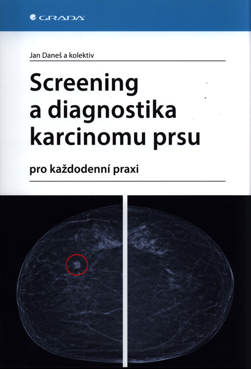 Screening a diagnostika karcinomu prsu : pro každodenní praxi