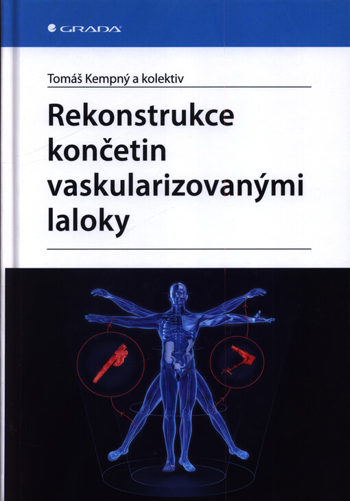 Rekonstrukce končetin vaskularizovanými laloky