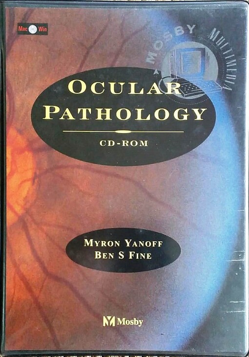 Ocular pathology