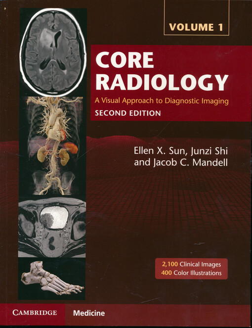 Core radiology : a visual approach to diagnostic imaging. Volume 1