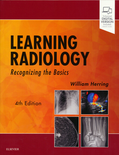 Learning radiology : recognizing the basics
