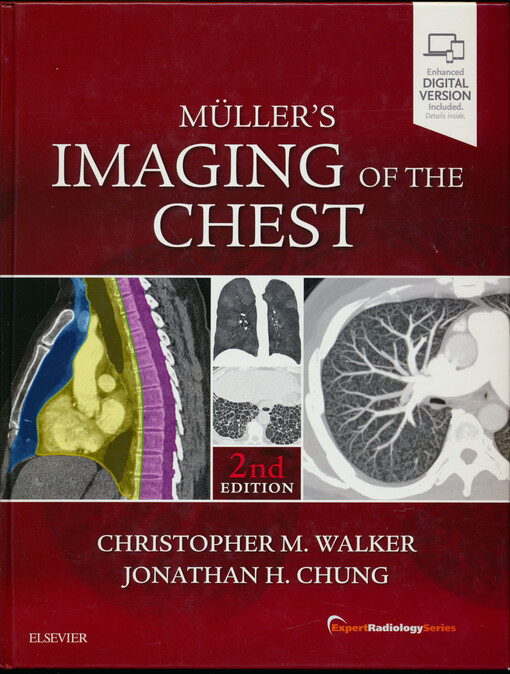 Müller's imaging of the chest