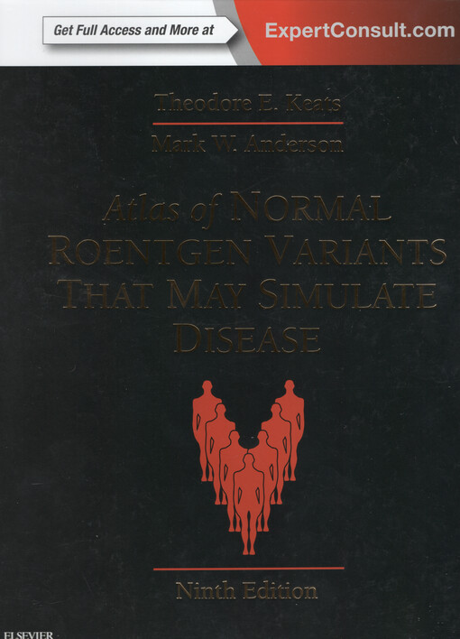 Atlas of normal roentgen variants that may simulate disease