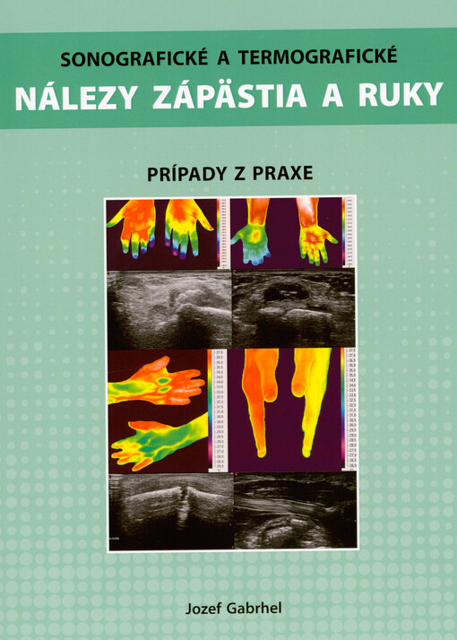 Sonografické a termografické nálezy zápästia a ruky : prípady z praxe