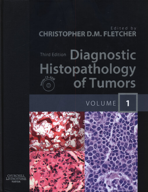 Diagnostic histopathology of tumors