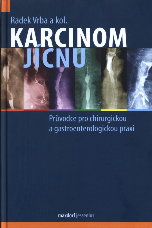 Karcinom jícnu : průvodce pro chirurgickou a gastroenterologickou praxi