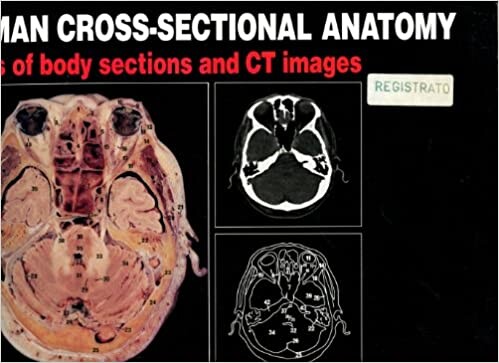 Human cross-sectional anatomy : atlas of body sections and CT images