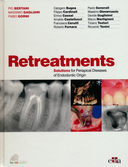 Retreaments : solutions for periapical diseases of endodontic origin