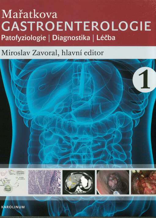 Mařatkova gastroenterologie : patofyziologie, diagnostika, léčba