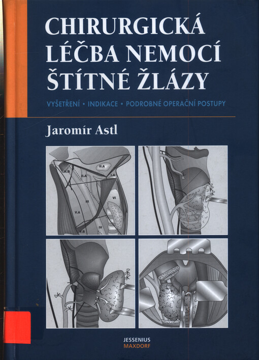 Chirurgická léčba nemocí štítné žlázy