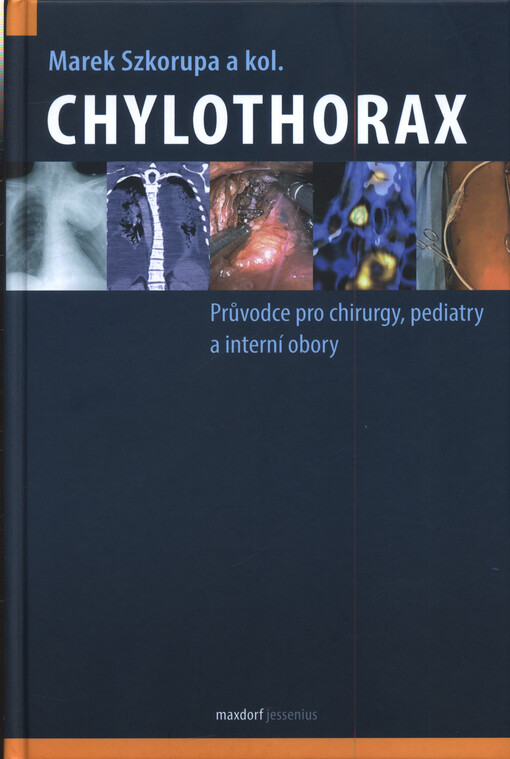 Chylothorax : průvodce pro chirurgy, pediatry a interní obory