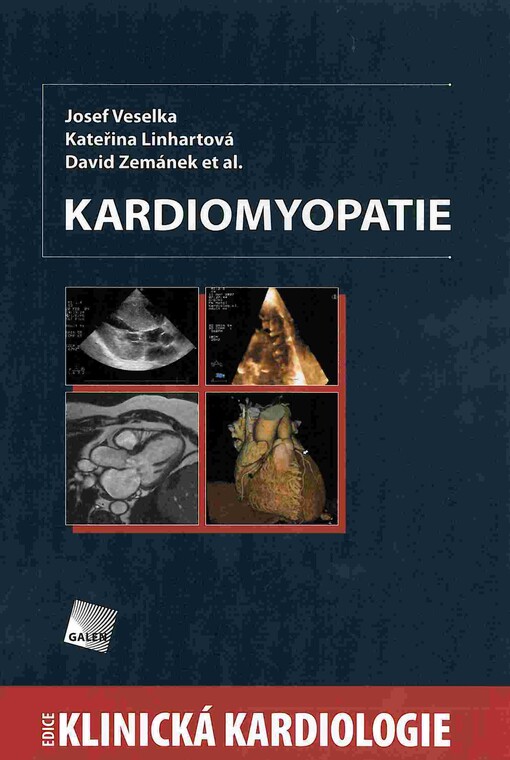 Kardiomyopatie