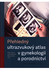 Přehledný ultrazvukový atlas v gynekologii a porodnictví  (odkaz v elektronickém katalogu)