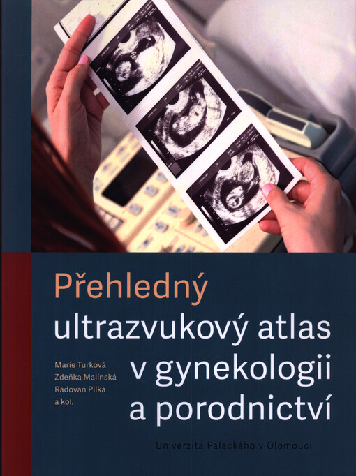 Přehledný ultrazvukový atlas v gynekologii a porodnictví