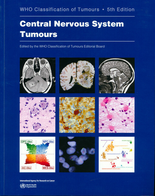 Central nervous system tumours : WHO classification of tumours