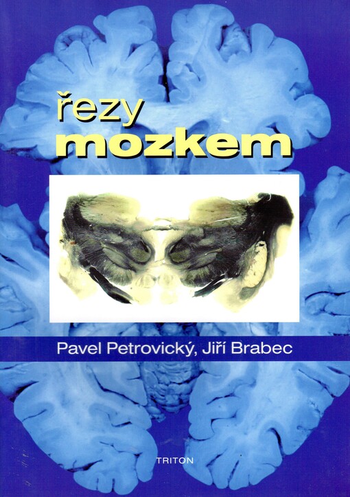 Řezy mozkem: frontální a horizontální