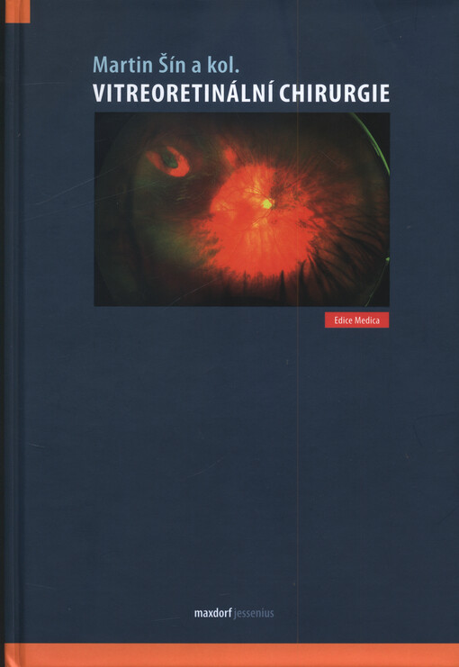 Vitreoretinální chirurgie