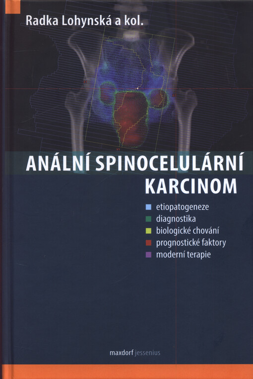 Anální spinocelulární karcinom