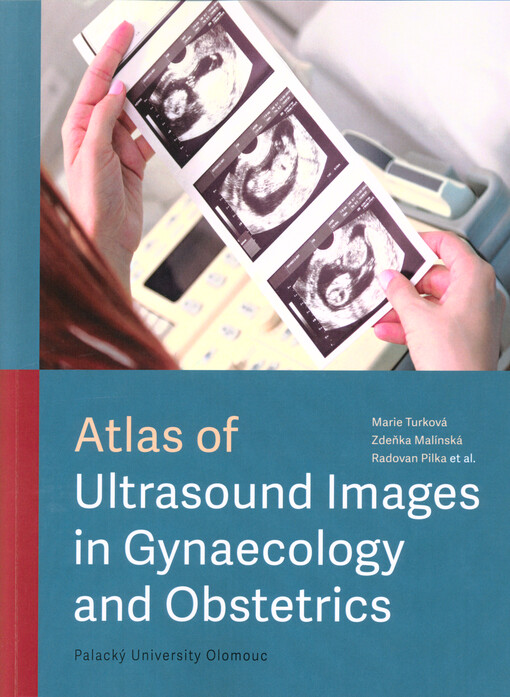Atlas of ultrasound images in gynaecology and obstetrics
