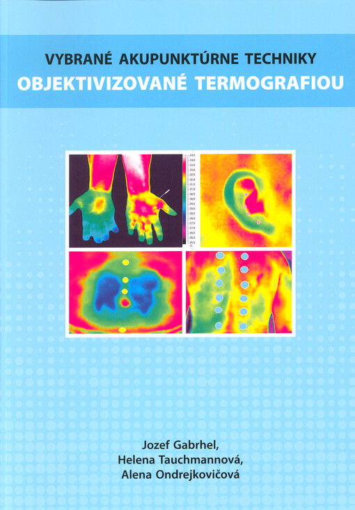 Vybrané akupunktúrne techniky objektivizované termografiou