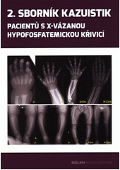 Sborník kazuistik pacientů s X-vázanou hypofosfatemickou křivicí (odkaz v elektronickém katalogu)
