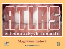 Atlas ortodontických anomálií